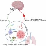 Los tumores pulmonares debilitan la inmunidad usando el encéfalo